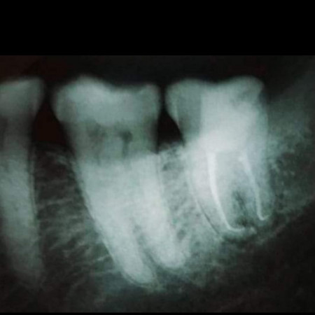 Difficult Anatomy Case